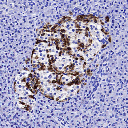 Fibroblast Activation Protein alpha/FAP Recombinant Rabbit mAb (S-3998-2)