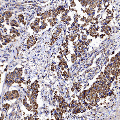 CLPP Recombinant Rabbit mAb (S-4169-31)