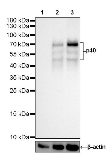 p40(BC28) Recombinant Rabbit mAb (SDT-166-36)