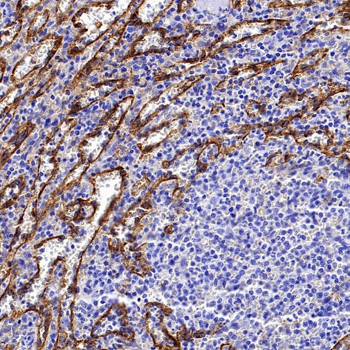 Mannose Receptor Recombinant Rabbit mAb (SDT-2206-52)