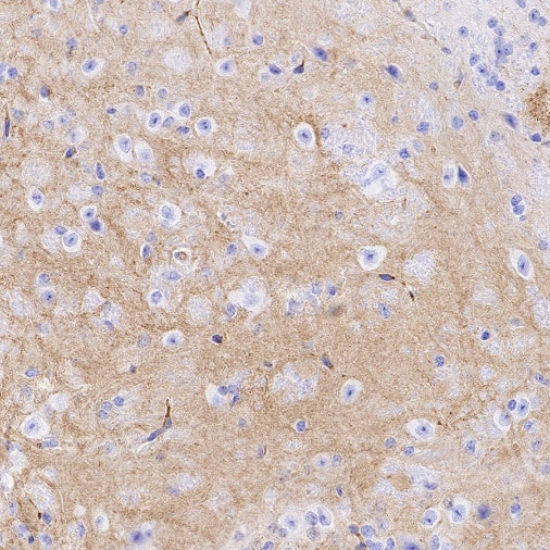 Sarcomeric Alpha Actinin Recombinant Rabbit mAb (S-1652-40)