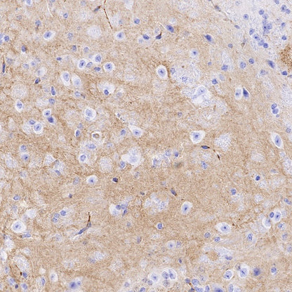 Sarcomeric Alpha Actinin Recombinant Rabbit mAb (S-1652-40)