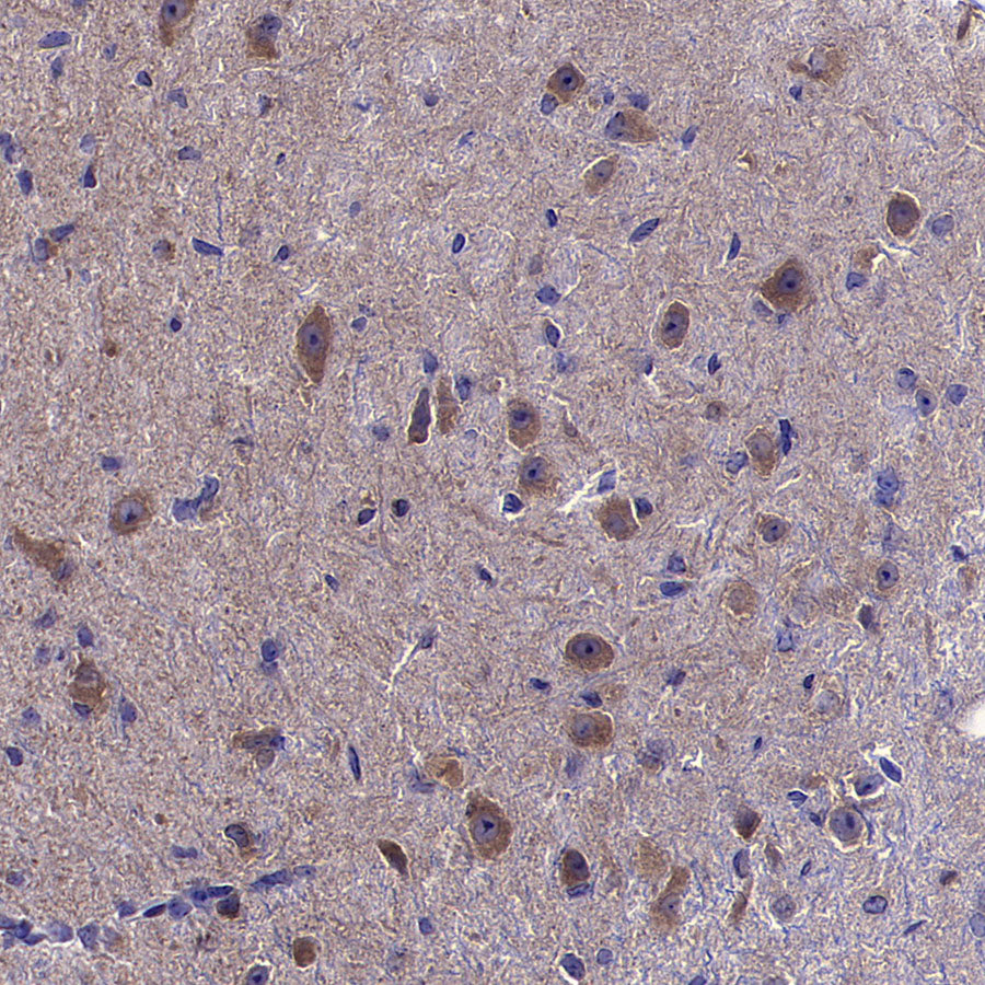 COPZ1 Recombinant Rabbit mAb (S-4445-53)