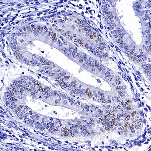 p21 Waf1/Cip1 Mouse mAb (469-2)