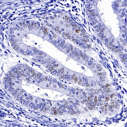 p21 Waf1/Cip1 Mouse mAb (469-2)