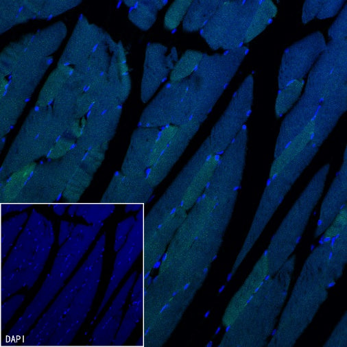 MYH7 Recombinant Rabbit mAb (SDT-2936-44)