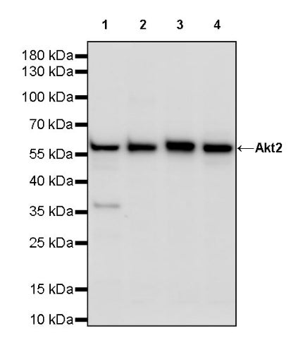 AKT2 Recombinant Rabbit mAb (S-3256)
