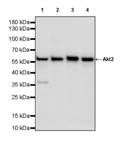 AKT2 Recombinant Rabbit mAb (S-3256)
