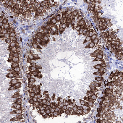 Stathmin 1 Recombinant Rabbit mAb (SDT-383-4)