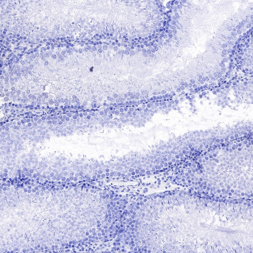 RNA polymerase II CTD repeat YSPTSPS (phosphor S2) Recombinant Rat mAb (S-R199)