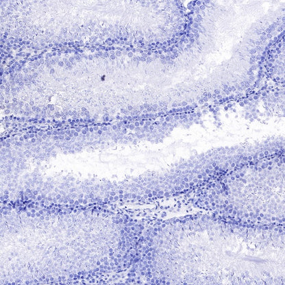 RNA polymerase II CTD repeat YSPTSPS (phosphor S2) Recombinant Rat mAb (S-R199)