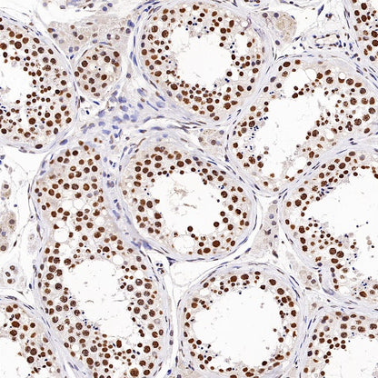 Histone H3 (mono methyl K79) Recombinant Rabbit mAb (S-R417)