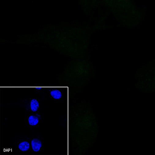 Progesterone Receptor Recombinant Rabbit mAb (Alex Fluor®488 Conjugate) (S-R123)