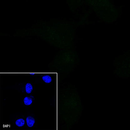 Progesterone Receptor Recombinant Rabbit mAb (Alex Fluor®488 Conjugate) (S-R123)