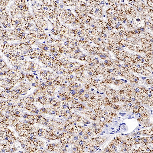 Rictor Recombinant Rabbit mAb (S-2601-26)