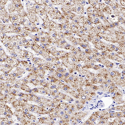 Rictor Recombinant Rabbit mAb (S-2601-26)