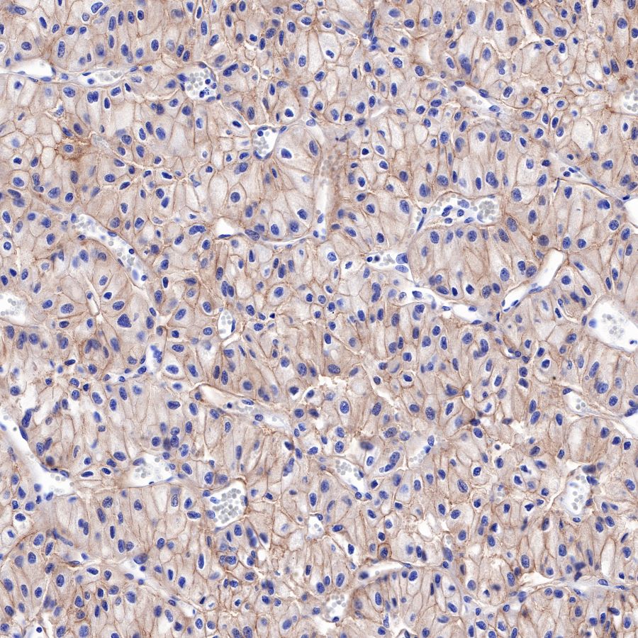 S-RMab® CD117 Recombinant Rabbit mAb,PBS Only (SDT-125-51)