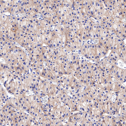 S-RMab® CD117 Recombinant Rabbit mAb,PBS Only (SDT-125-51)