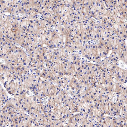 S-RMab® CD117 Recombinant Rabbit mAb,PBS Only (SDT-125-51)
