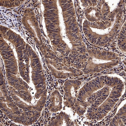 SEK1/MKK4 Rabbit Polyclonal Antibody