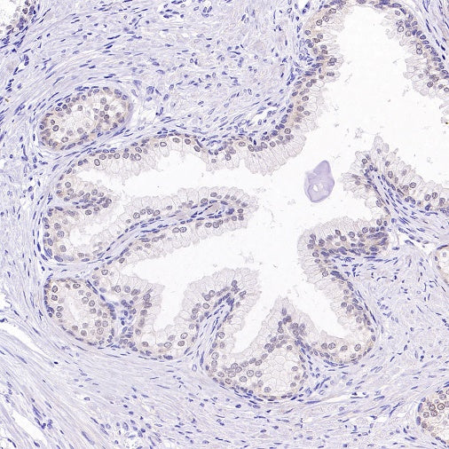 PRMT5 Recombinant Rabbit mAb (S-2336-126)