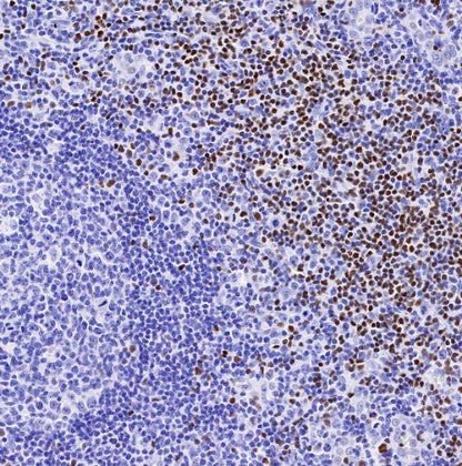 LEF1 Recombinant Rabbit mAb (S-500-34)