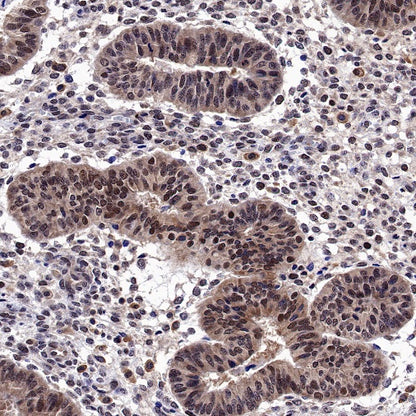 Helios Recombinant Rabbit mAb (S-1299-31)