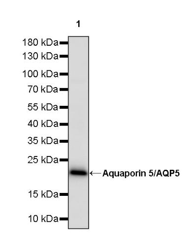 Aquaporin 5/AQP5 Recombinant Rabbit mAb (S-1610-43)