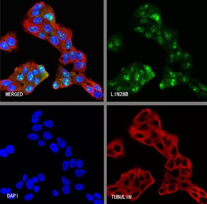 LIN28B Recombinant Rabbit mAb (S-2360-117)