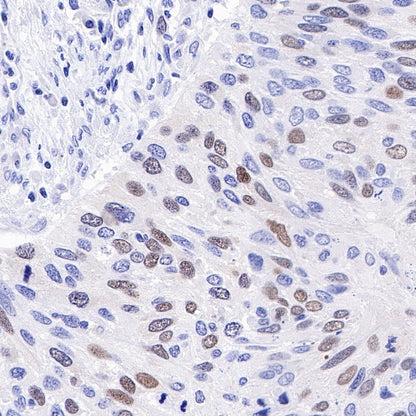 Geminin Recombinant Rabbit mAb (S-427-204)