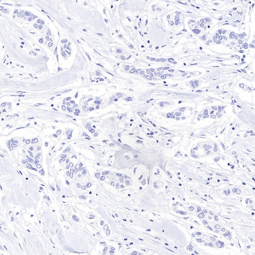 PAP Recombinant Rabbit mAb (SDT-702-140)