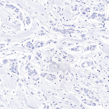 PAP Recombinant Rabbit mAb (SDT-702-140)