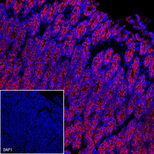 E-Cadherin Recombinant Rabbit mAb (Alexa Fluor® 555 Conjugate) (S-438-5)