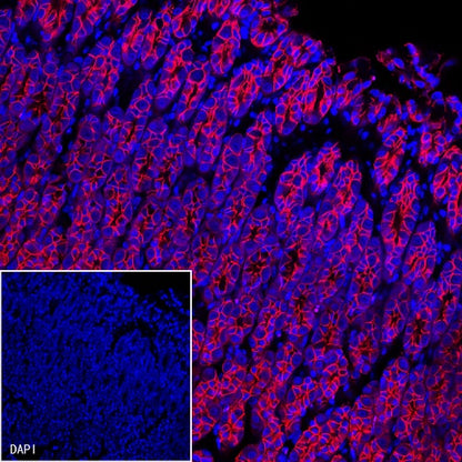 E-Cadherin Recombinant Rabbit mAb (Alexa Fluor® 555 Conjugate) (S-438-5)