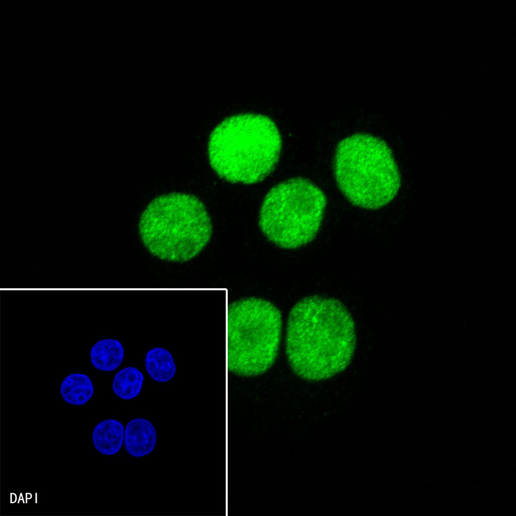 CDX2 Recombinant Rabbit mAb (SDT-134-76)