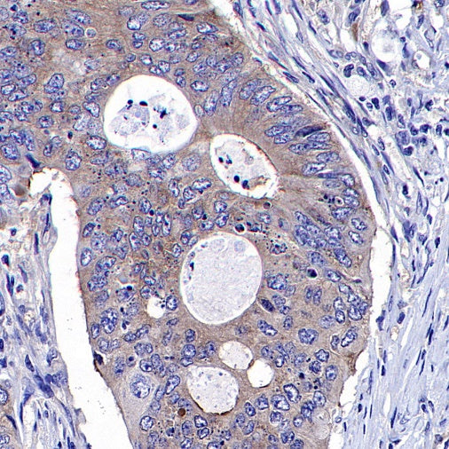eIF3B Recombinant Rabbit mAb (S-816-8)