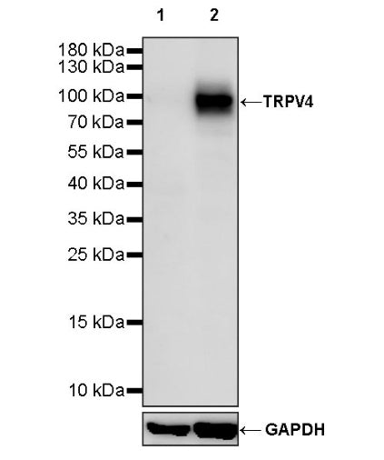 TRPV4 Recombinant Rabbit mAb (S-1746-65)