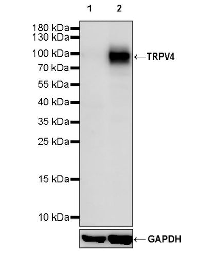 TRPV4 Recombinant Rabbit mAb (S-1746-65)