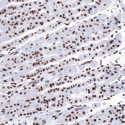 Histone H3 (acetyl K4 + K9 + K18) Rabbit polyclonal antibody