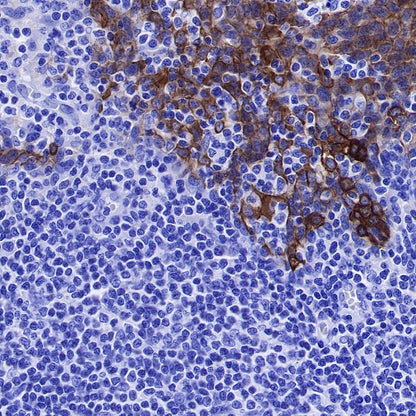p120 Catenin Recombinant Rabbit mAb (SDT-350-75)