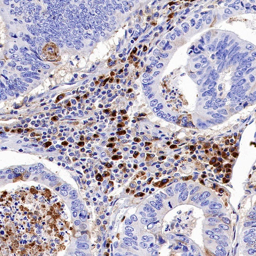 TIM-3 Recombinant Rabbit mAb (S-1450-21)