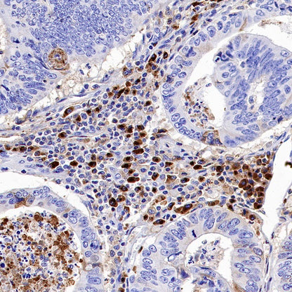 TIM-3 Recombinant Rabbit mAb (S-1450-21)