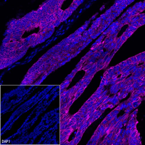 CK-Pan Recombinant Rabbit mAb (Alexa Fluor® 647 Conjugate) (S-P001)