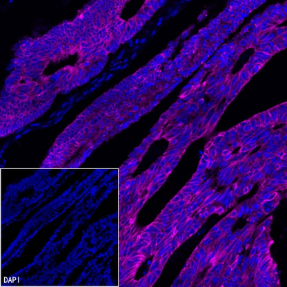 CK-Pan Recombinant Rabbit mAb (Alexa Fluor® 647 Conjugate) (S-P001)