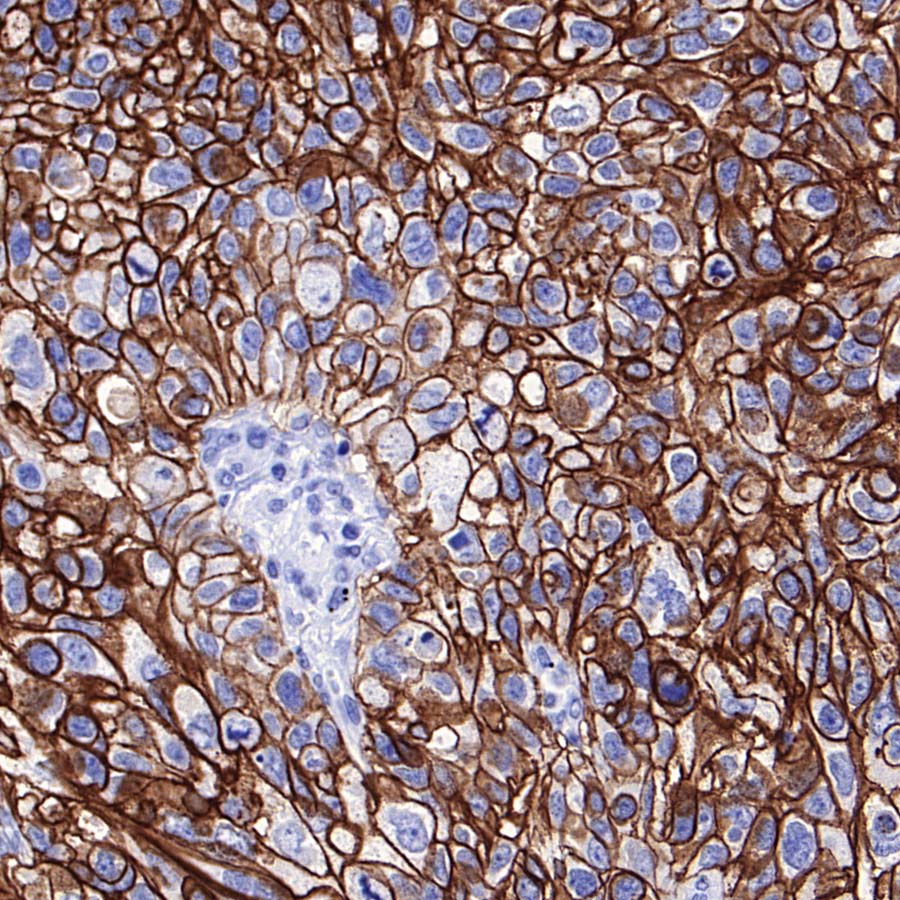 ALCAM Recombinant Rabbit mAb (S-4080-21)