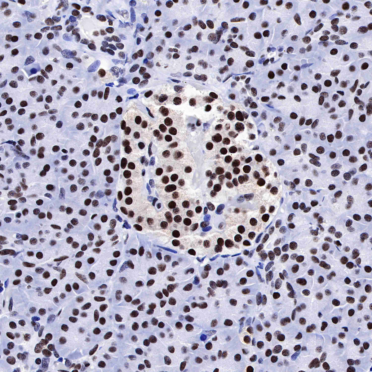 FUBP1 Recombinant Rabbit mAb (SDT-R060)