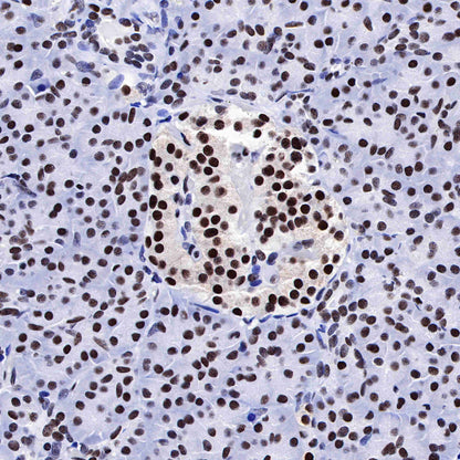 FUBP1 Recombinant Rabbit mAb (SDT-R060)