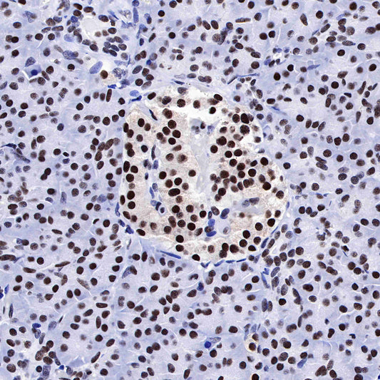 FUBP1 Recombinant Rabbit mAb (SDT-R060)