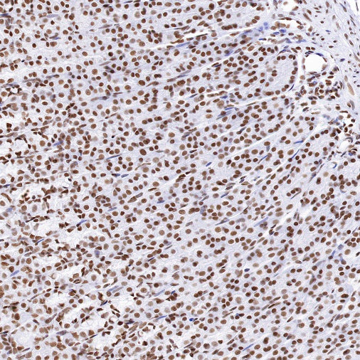 CTCF Recombinant Rabbit mAb (S-1822-42)