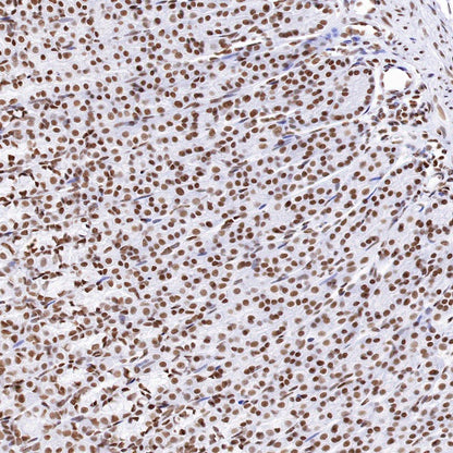 CTCF Recombinant Rabbit mAb (S-1822-42)